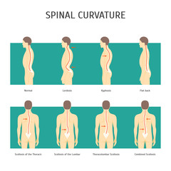 Cartoon Back with Scoliosis Card Poster. Vector