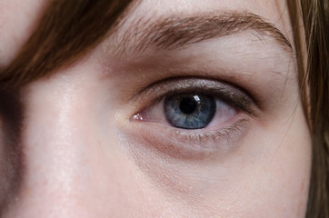 eye
