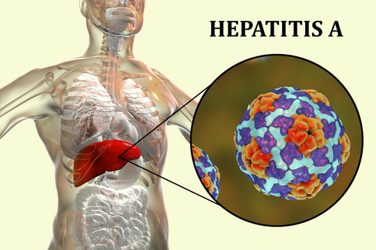 Hepatitis A viruses HAV in liver, 3D illustration. HAV infect humans through contaminated water, food and dirty hands through intestine they come to liver and cause hepatitis