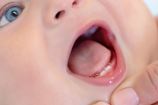 Mother open baby mouth to examine first teeth. Infant primary dentition. Children healthcare and toothing concept