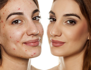 comparition portrait of same woman before and after cosmetic treatment amd makeup on white background © vladimirfloyd