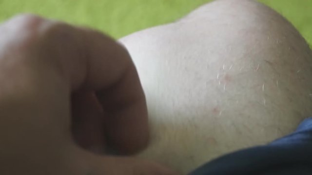 man with his hand scratches his hairy leg, knee, close-up