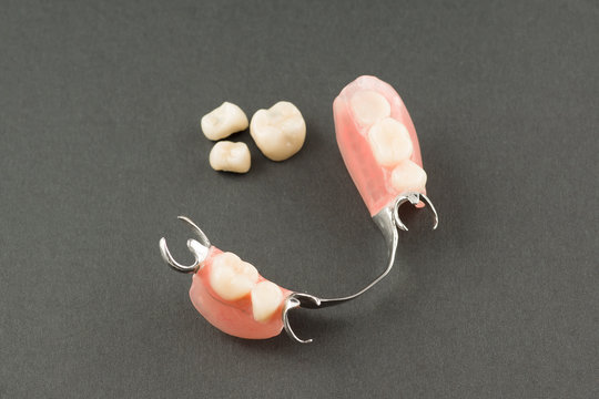 large image of a modern denture