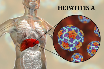 Hepatitis A viruses HAV in liver, 3D illustration. HAV infect humans through contaminated water, food and dirty hands through intestine they come to liver and cause hepatitis