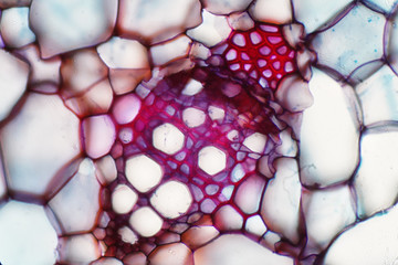 Plant vascular tissue under microscope view.