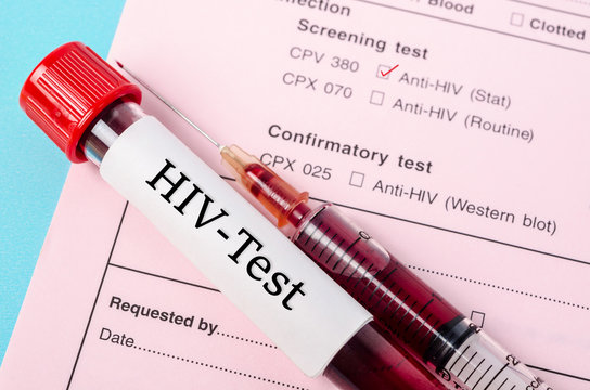 HIV test concept.