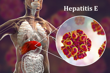 Hepatitis E viral infection, 3D illustration. Non-enveloped RNA viruses with fecal-oral transmission route, the causative agent of hepatitis - obrazy, fototapety, plakaty