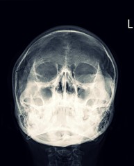 X-ray Any Positioning