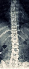 X-ray Any Positioning