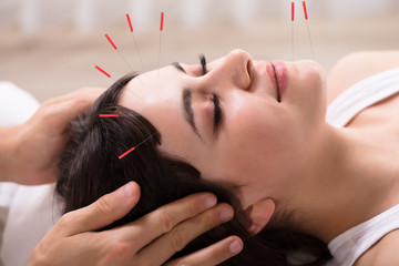 Woman Receiving Acupuncture Treatment - obrazy, fototapety, plakaty