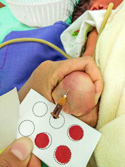 Nurse taking Blood specimens baby goiter,sample blood for thyroid,selective focus.