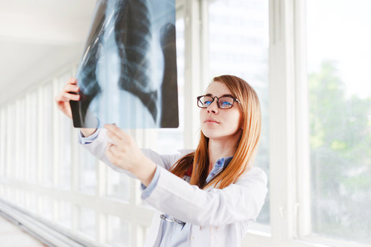 Young female doctor looking at the x-ray picture of lungs in hospital