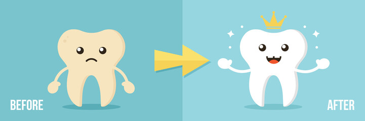 Cute cartoon vector illustration, concept of two teeth characters before and after whitening procedure.
