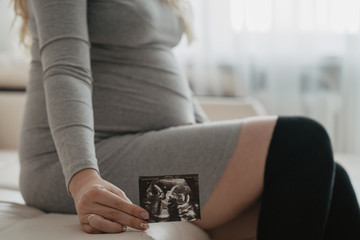 Young pregnant woman sitting at home and holding her recent ultrasound picture
