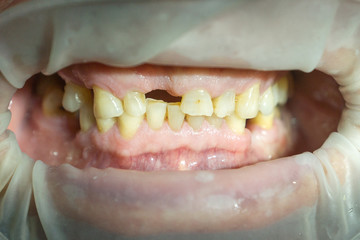 Fototapeta premium work of the stosatologist