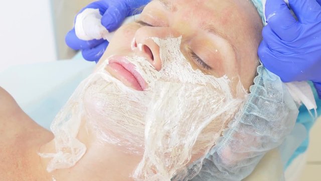 procedure for cleaning the face in the doctor's office of a dermatologist. 4k, close-up, slow-motion . Squeezing the infected pustulous acne to inoculation