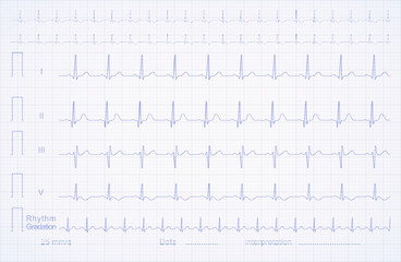 Naklejka premium ECG pattern on the linear graph paper, vector illustration