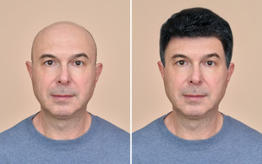 Two portraits of a same middle aged bald man before and after wearing wig