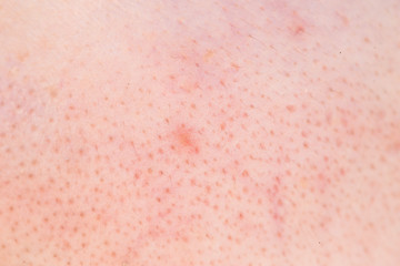 close up of black head