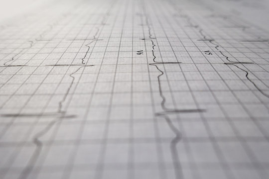 heart test ekg printed graph sheet