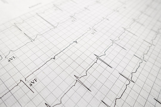 heart test ekg printed graph sheet