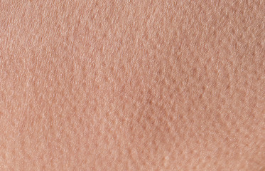 background of a pink skin texture of a man covered with pores and small goosebumps