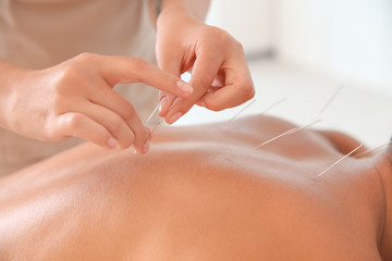 Young man undergoing acupuncture treatment in salon, closeup - obrazy, fototapety, plakaty