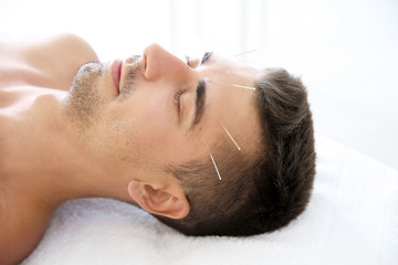 Fototapeta na wymiar Young man undergoing acupuncture treatment in salon