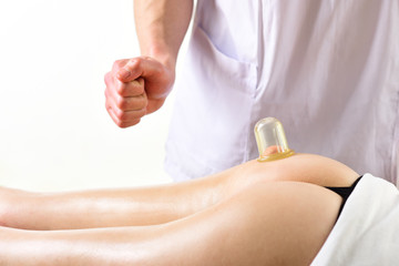 cellulite. cellulite cupping jar therapy in spa salon. cellulite fighting for perfect buttocks. man...