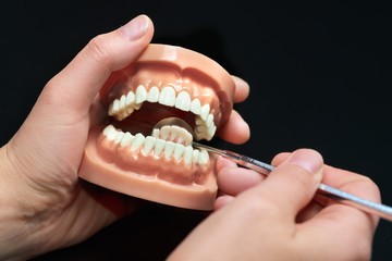 Dental model, observation using dental mirror