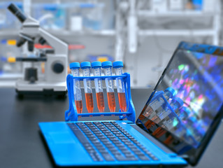 Microscope, liquid samples and portable computer with microscopic image