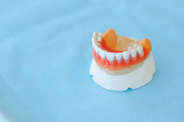 Denture on a blue background. Dental prosthetics for teeth. Place under the text. Background.