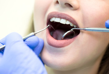 Close-up picture of young woman sitting in the dentist's chair with opened mouth at dentist's office while having examination.