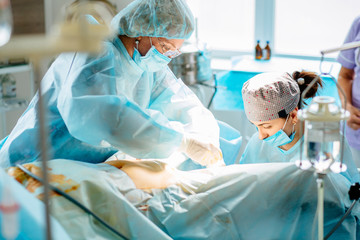 Process of Gynecological surgery operation. Female doctors performing gynecological operation at the hospital healthcare medicine gynecology treatment curing help assistance experience. Real scene - obrazy, fototapety, plakaty