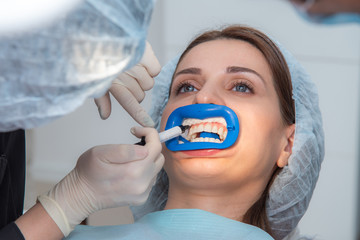 Preparing the oral cavity for whitening with an ultraviolet lamp. Close-up