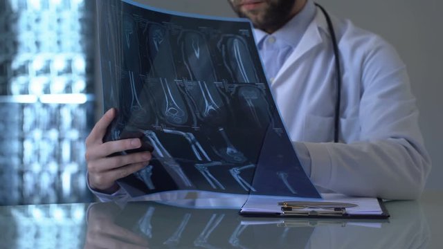 Experienced traumatologist looking at leg x-ray and making notes in medical form