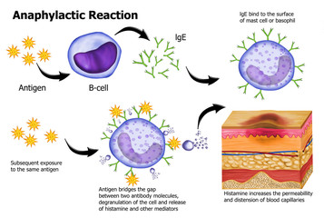 Mechanism of allergy