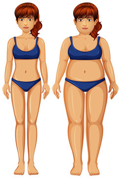 Set of healthy and unhealthy woman figure