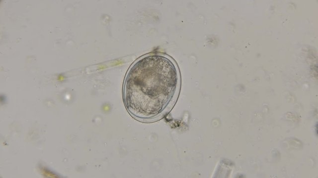 egg Rotatoria ready to hatch, under a microscope