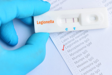 Legionella positive test result by using rapid test cassette