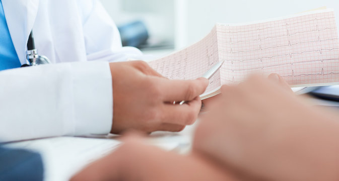 Professional male doctor is explaining the result selectrocardiogram to patients. Medical and healtcare concept.