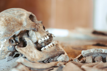 the human skull lies