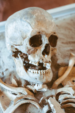the human skull lies