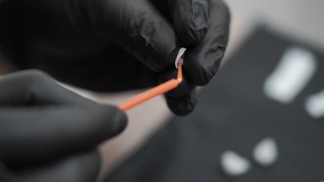 Using glue for veneers in dental clinic
