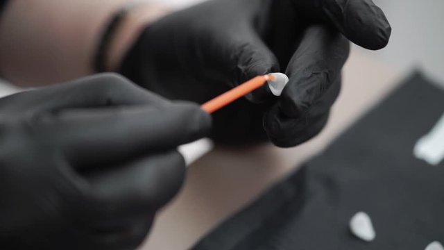 Using glue for veneers in dental clinic