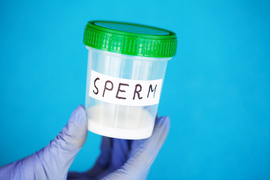 Health. Sperm Analysis. Concept of Bank Sperm. Infertility. Doctor's Hand Holding Container for Analyzes