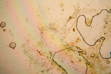Fresh pond water plankton and algae at the microscope. Dead copepod details

