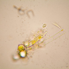 Fresh pond water plankton and algae at the microscope

