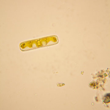 Fresh pond water plankton and algae at the microscope. Diatoms

