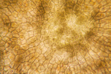 Onion root cells at the microscope 
